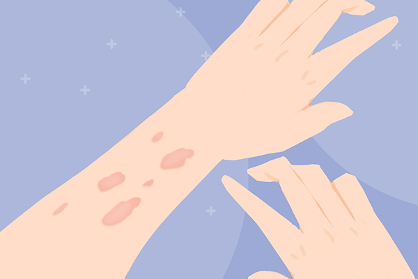 �ƺְ��ܳ�������� ����ƺְߵ�����Ч�ķ���